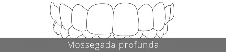 La mossegada profunda pot provocar problemes de genives, irritació i desgast de les dents inferiors, a més de dolor a la mandíbula i problemes en l'articulació.